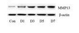 The expression of MMP13.jpg